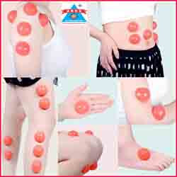 Vaccum Cupping Half Ball 12 Piece Set-Code 1313-वैक्यूम कपिंग हाफ बॉल-Acupressure-Easy to Use-Massager-Activate Acupressure Points