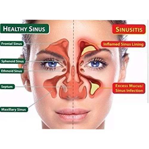 Jal Neti Lota Steel For Sinus-Code 1815-जल नेति लोटा-Acupressure-Easy to Use-Massager-Activate Acupressure Points