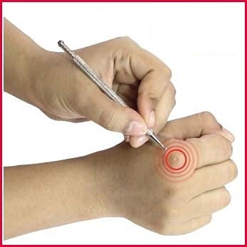 Sujok Jimmy Mattel still Pointer Set Of-6pc sujok therapy points pressure kit