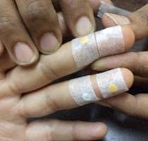 Acupressure Sujok Star Magnet Small Ayurvedic (3.5mm approx.) Pack of 50 + 1pc One Inch tape