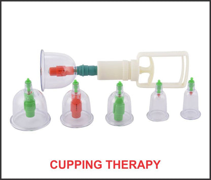 Acupressure Vaccum Cupping Set Best 6 Cup कपिंग 6 सेट AC-1303