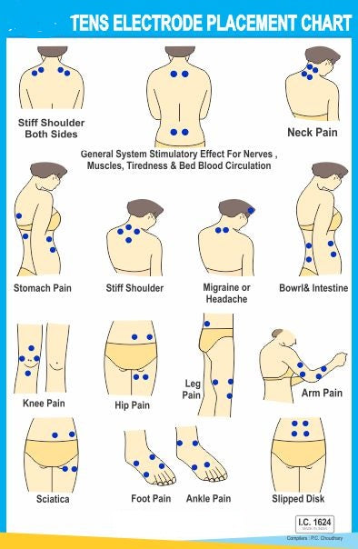 TENS Electrode Placement Chart  AC-1624