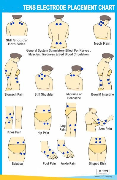 TENS Electrode Placement Chart  AC-1624